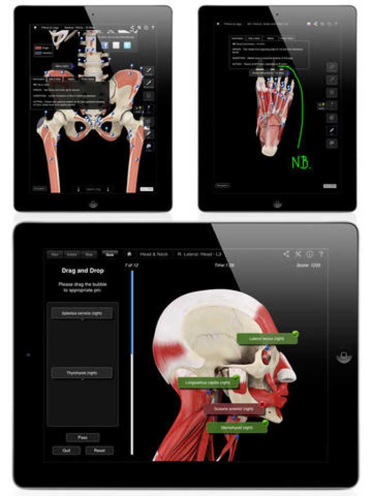 Muscle System Pro III (NOVA Series) - iPad edition